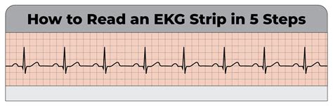 How to Read an EKG Strip in 5 Steps .
